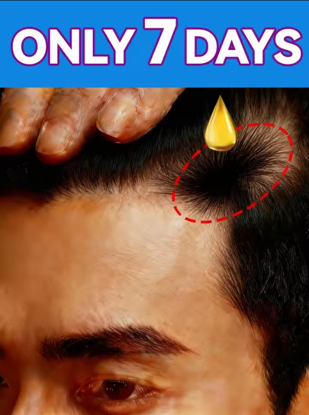 Hair Care Essence Oil Spray - Biotin fast Hair Growth oil Products
