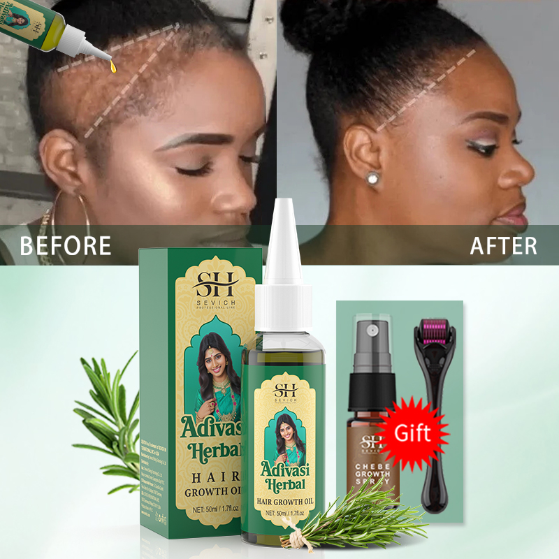Ayurvedic Hair Growth Oil Indi - Hair Care Essence Oil Spray recension och pris