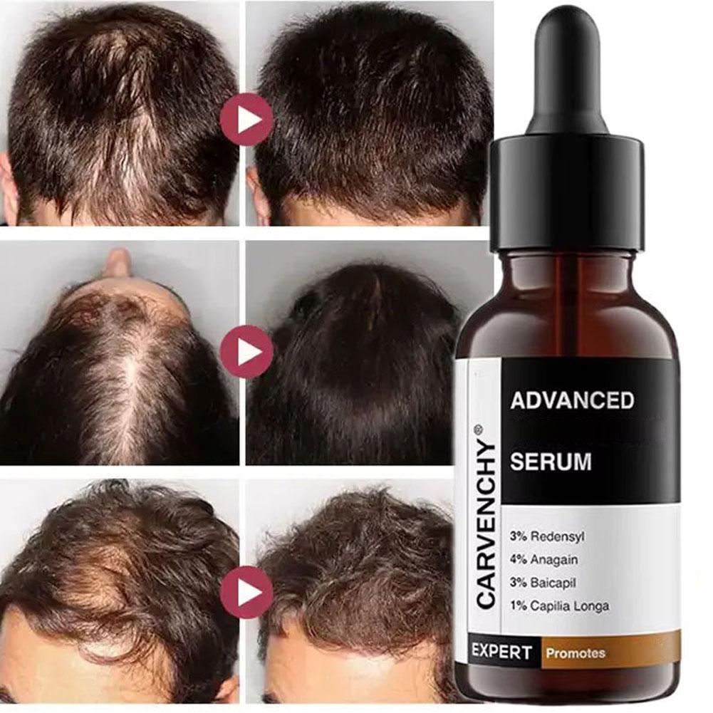 Rosemary Essential Oil For Hai - Hair Care Growth recension och pris