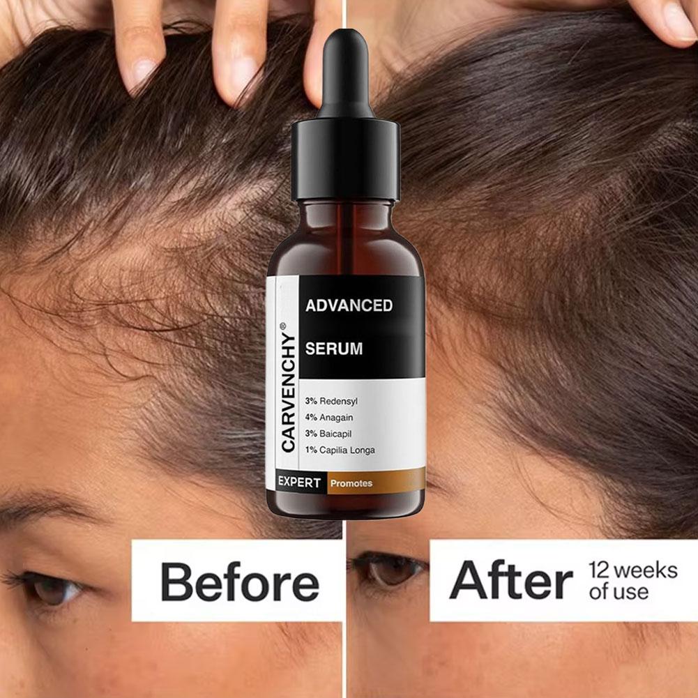 Rosemary Essential Oil For Hai - Hair Care Growth recension och pris