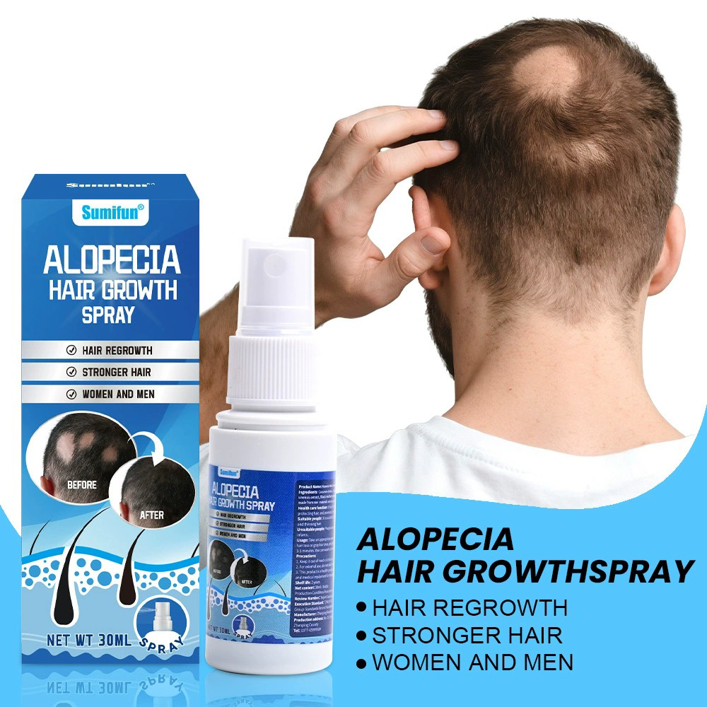 Alopecia Hair Growth Spray Sop - Hair Care Growth recension och pris