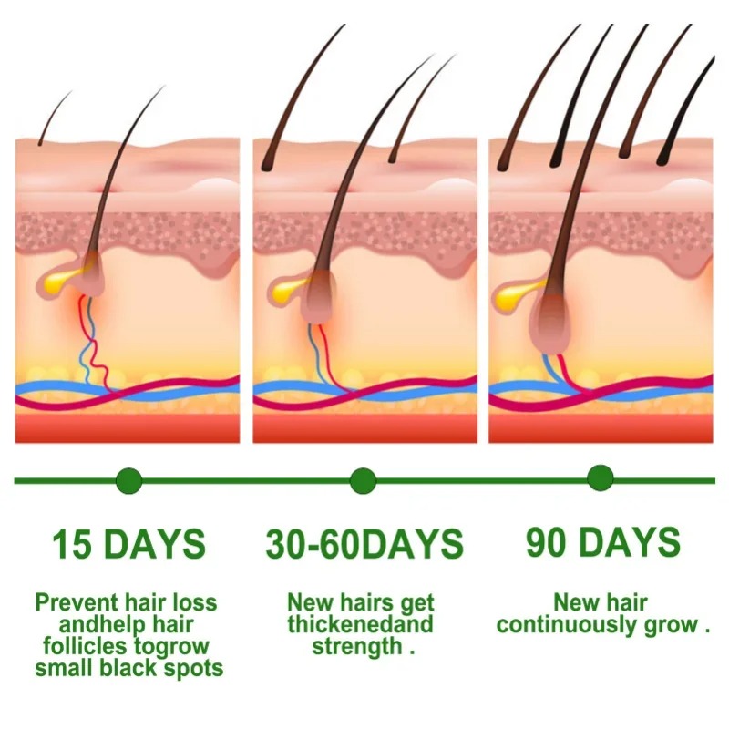Hair Growth Serum Fast Growing - Hair Care Essence Oil Spray recension och pris