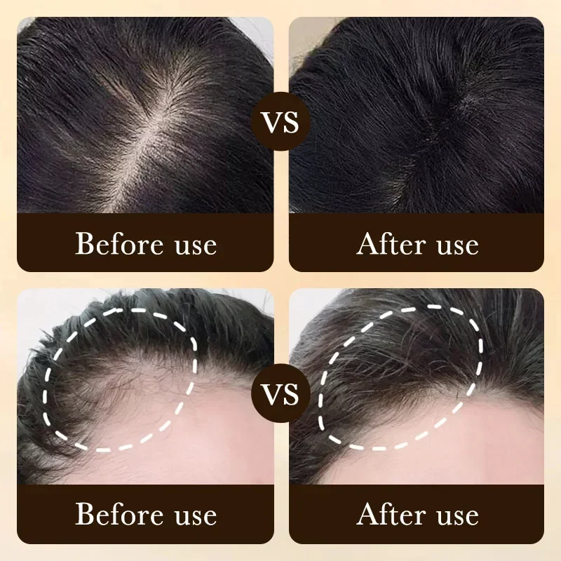 Biotin fast Hair Growth oil Pr - Hair Care Essence Oil Spray recension och pris