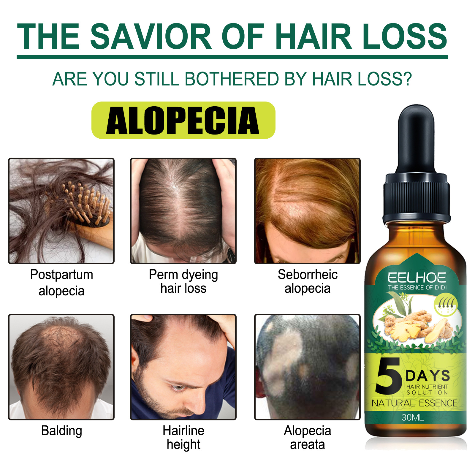 5Days Ginger Scalp Serum Dropp - Hair Care Essence Oil Spray recension och pris