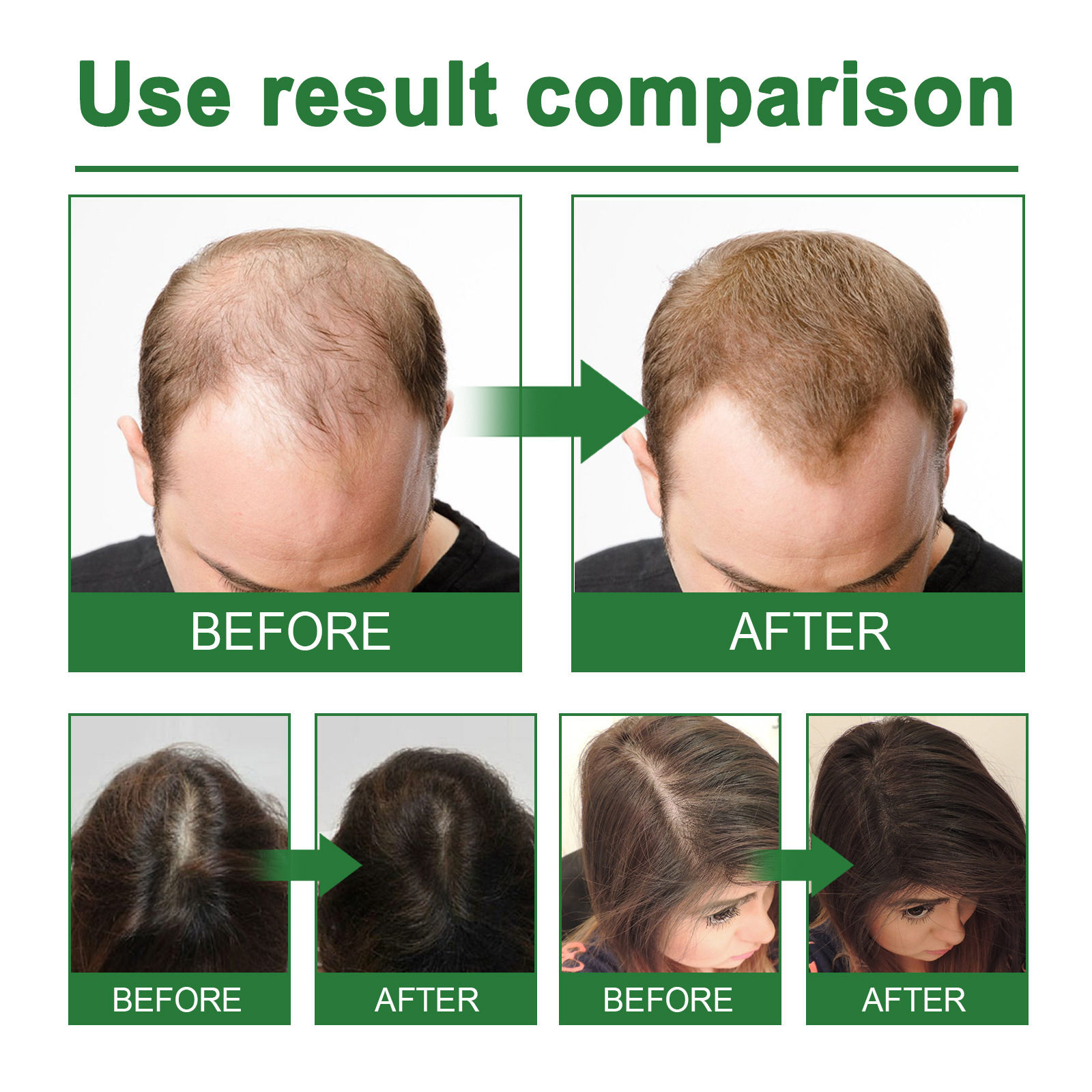 Rosemary Spray for Hair Nouris - Hair Care Growth recension och pris