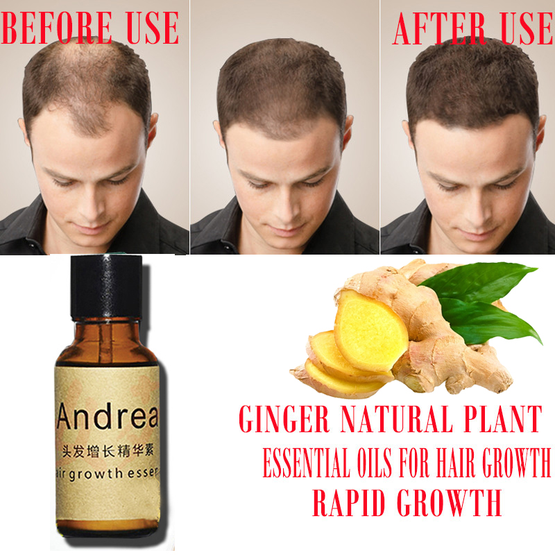 2/5/10Pcs Andrea Hair Growth S - Hair Care Essence Oil Spray recension och pris