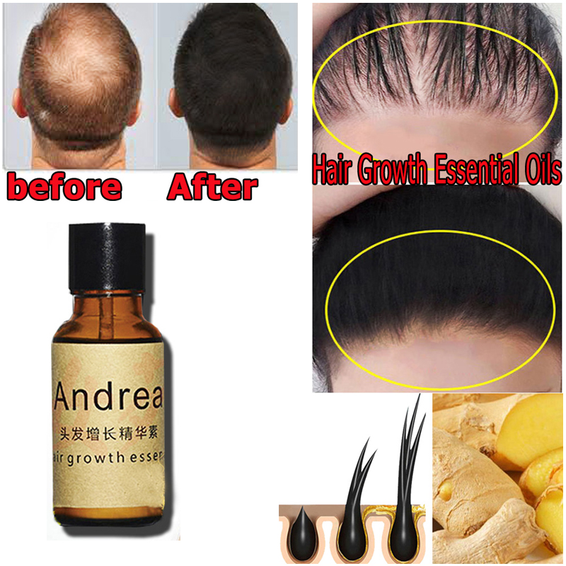 2/5/10Pcs Andrea Hair Growth S - Hair Care Essence Oil Spray recension och pris
